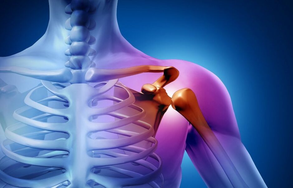 Osteoartrit nedeniyle omuz eklemi yaralanması