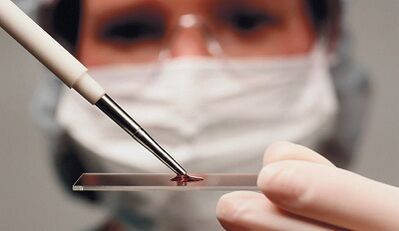 Nitelik ve osteoartritin ayırıcı tanısı