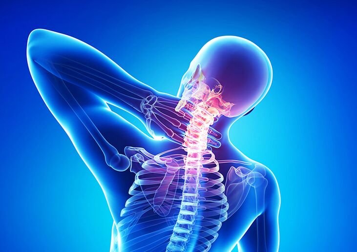 Spinal osteokondroz, eklem kıkırdağını ve omurları etkileyen bir hastalıktır.